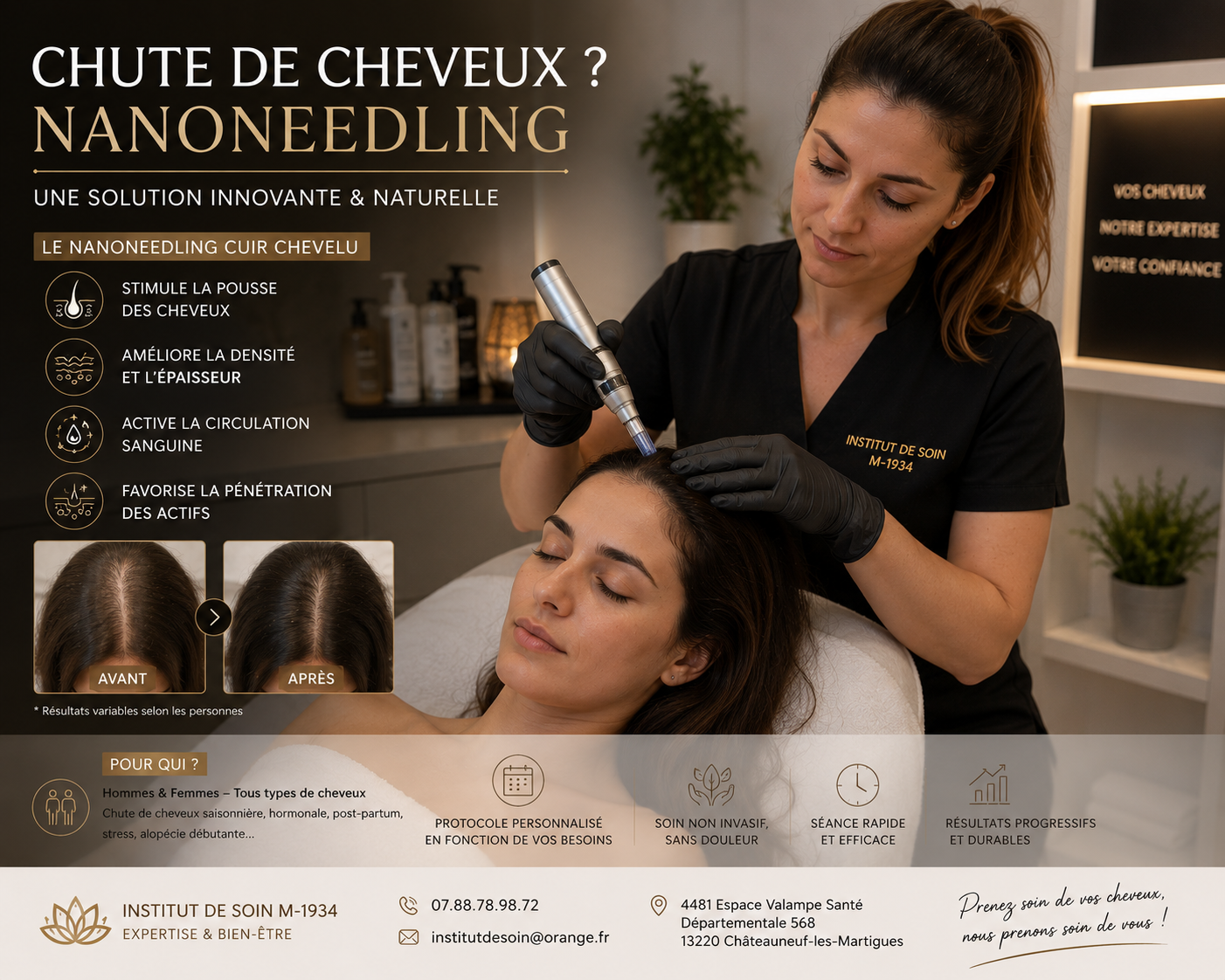 Nanoneedling cuir chevelu à l’Institut de Soin M-1934, Plan-de-Cuques